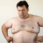 get rid of man boobs