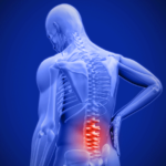 lower back pain relief
