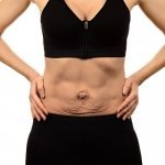 How to prevent loose skin when losing weight now