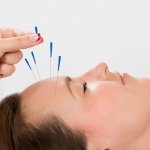 Acupuncture for weight loss