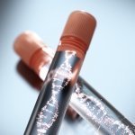 Genetic testing