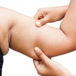 How to Get Rid of Underarm Fat Quickly