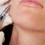 exercise after botox