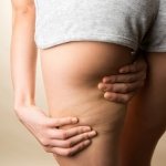 woman examining sagging skin on legs while standing