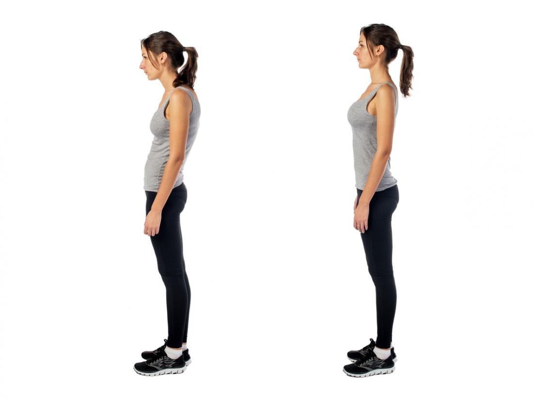    7 Proven Tips on How to Fix Rounded Shoulders