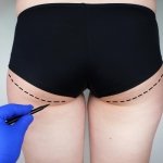 5 Tips on How to Get Underbutt Crease (Plus Best Exercises)