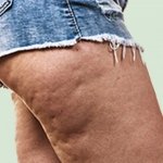 While your main question was does collagen help with cellulite, this section will provide you with more ways on how to get rid of your cellulite.