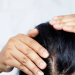 Everything You Need to Know About Happy Head Reviews