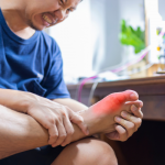 gout pain relief cream