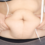 Bye Bye Belly Juice side effects 1