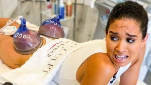 10 Surprising Vacuum Therapy Buttocks Side Effects 3 Negative Vacuum Therapy Buttocks Side EffectsÂ