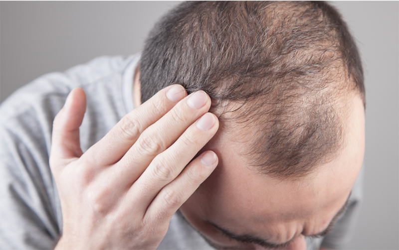 RU58841 Side Effects 1