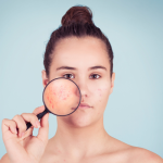 Side effects of Seysara on skin and health | Seysara side effects