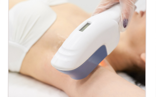 10 Crazy Cool Peel Laser Side Effects You Need to Know 2 A woman discussing cool peel laser side effects for her healthy lifestyle journey.