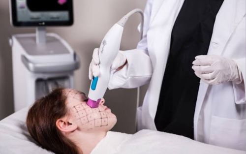 Blog 89 A Woman researching bad thermage side effects for a safe healthy lifestyle transformation.