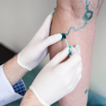 Vein doctor